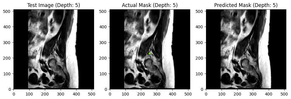 Test1 - MRI-SEG Lite
