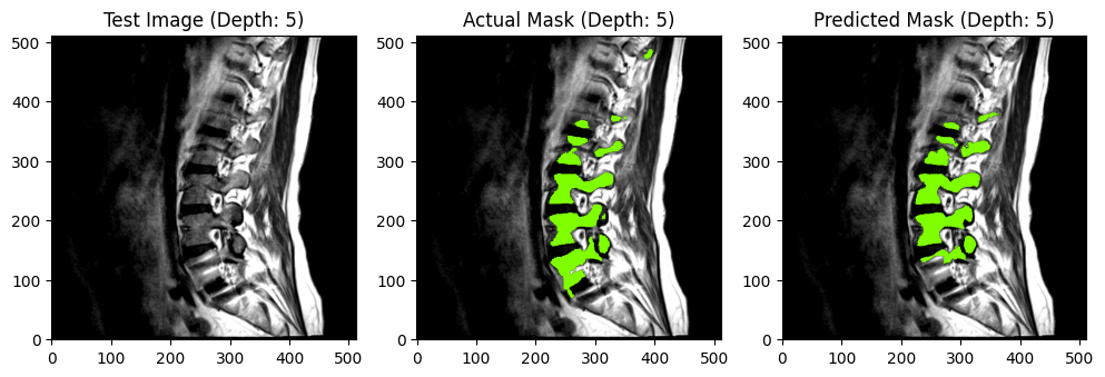 Test1 - MRI-SEG Lite
