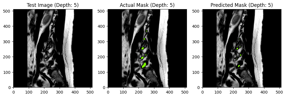 Test1 - MRI-SEG Lite